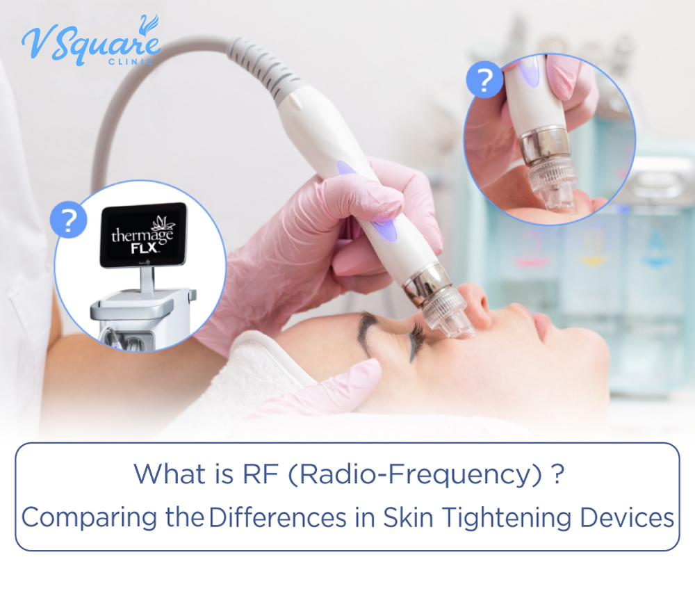 RF (Radio-Frequency)