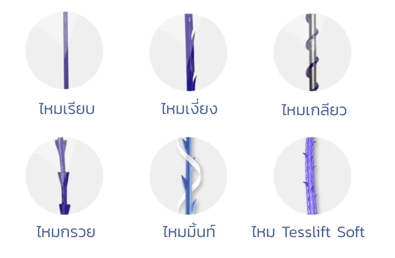 Types of threads