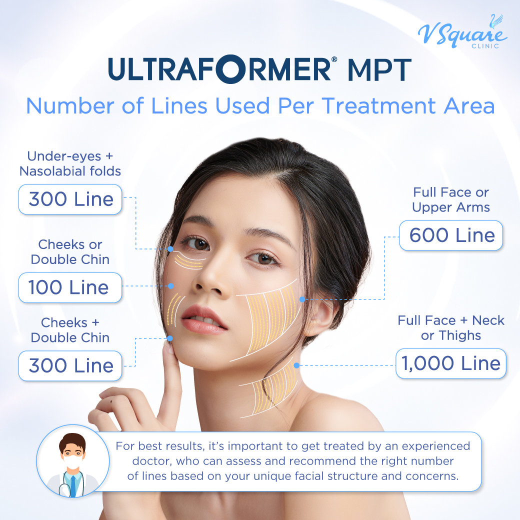 Ultraformer MPT Price by treatment area – number of lines used