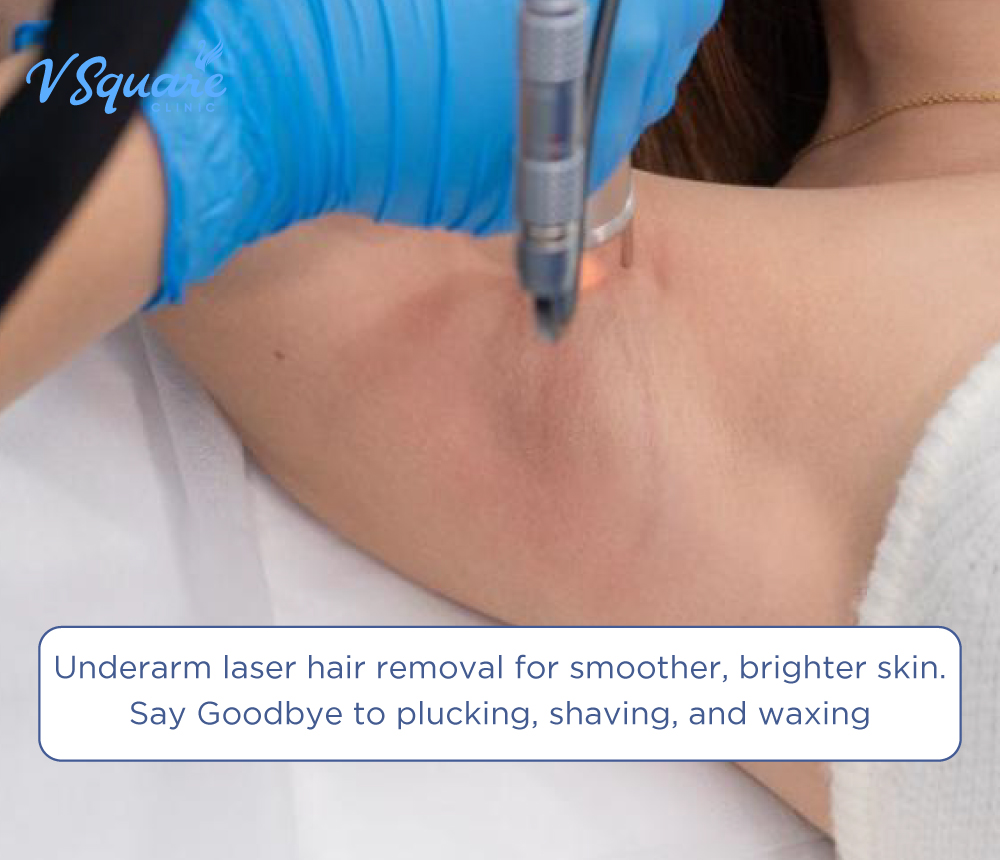 Underarm laser hair removal