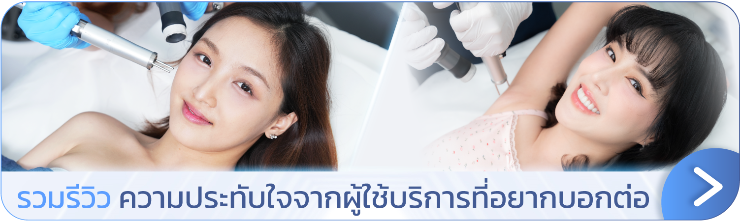 Underarm laser review banner