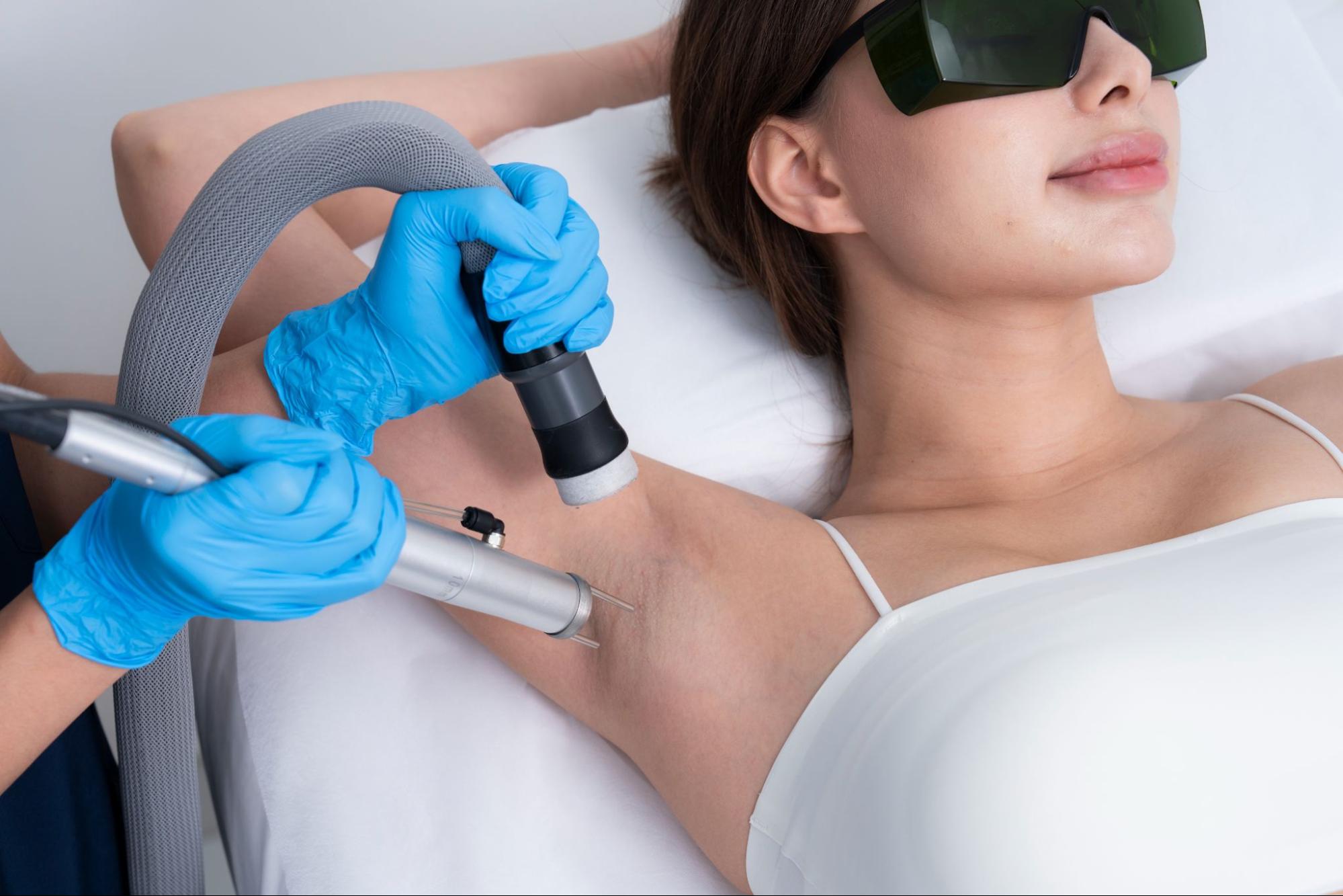 Underarm laser treatment