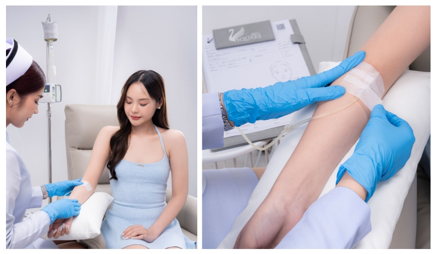 Vitamin IV drip hangover remedy