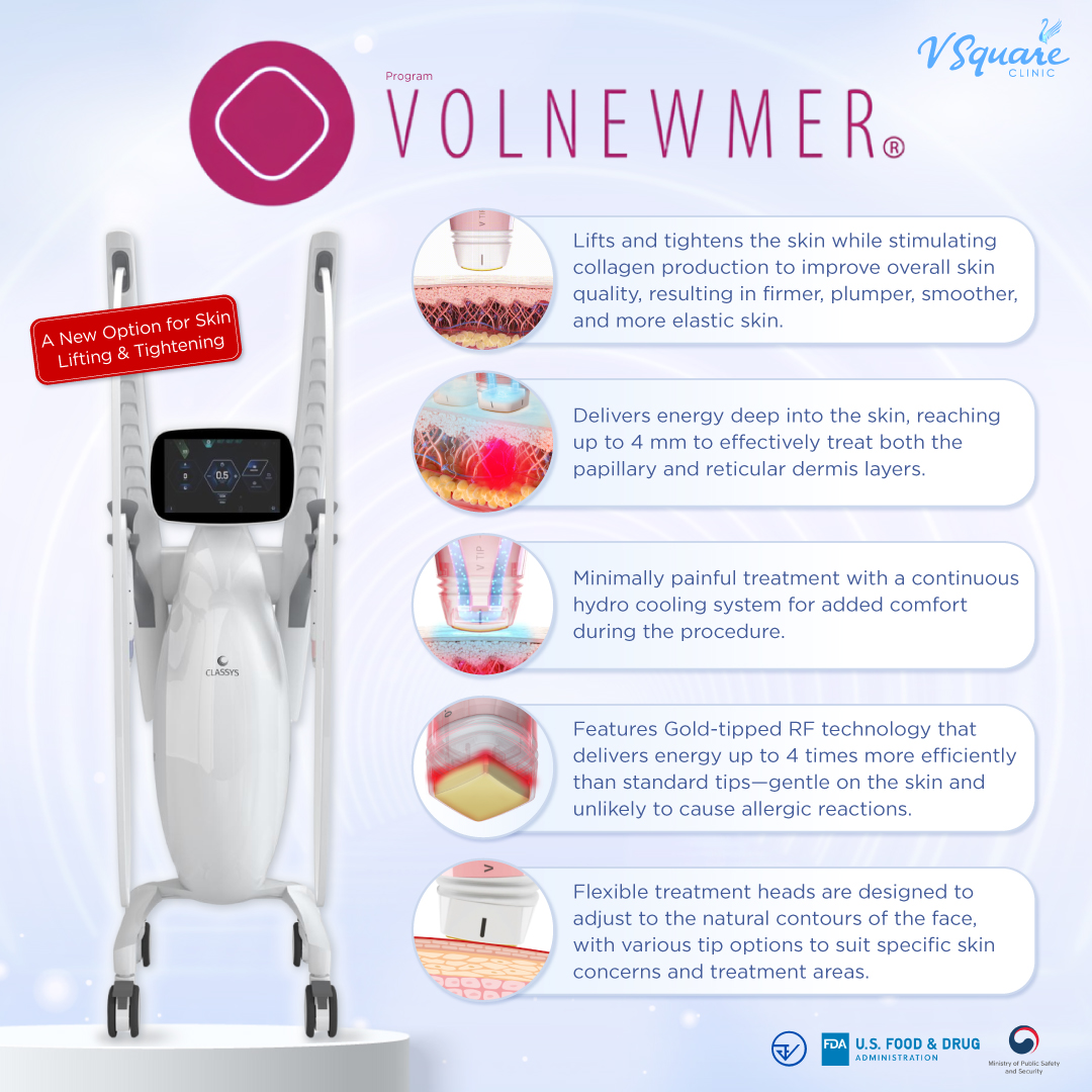 Volnewmer facial lifting