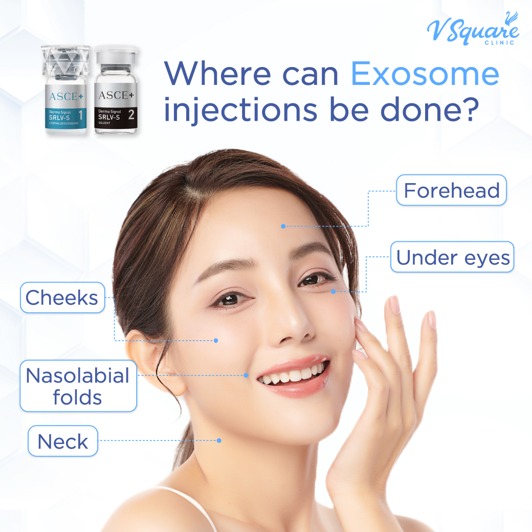 Which Areas Can Be Treated with Exosome_