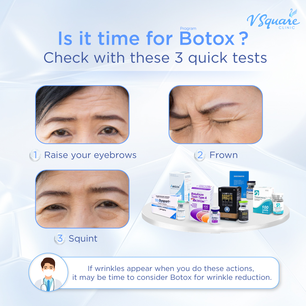 Who is suitable for Botox wrinkle reduction
