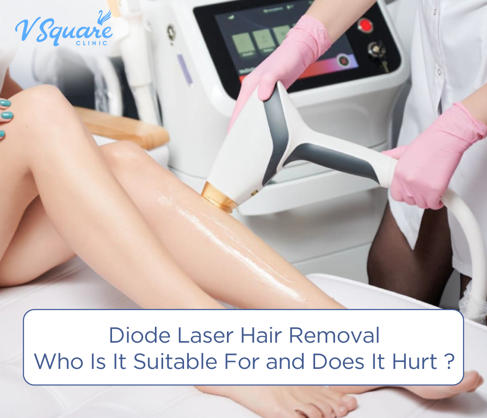diode laser