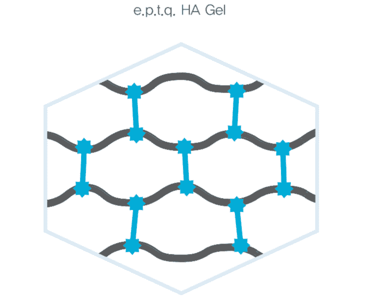 How e.p.t.q. filler works