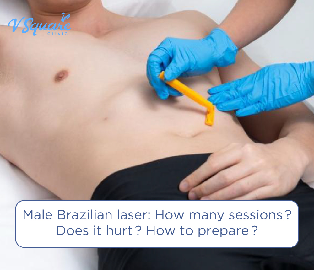 Male Brazilian laser hair removal