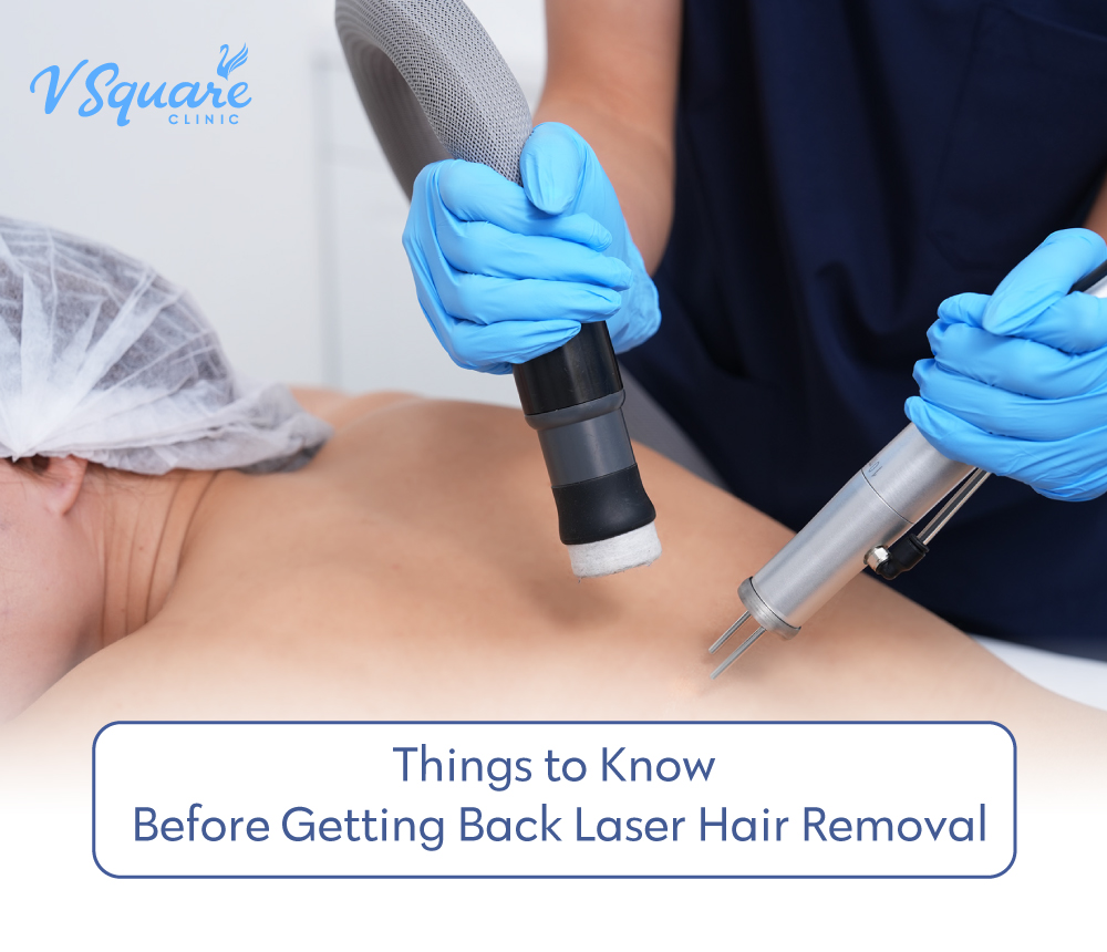 Back Laser Hair Removal