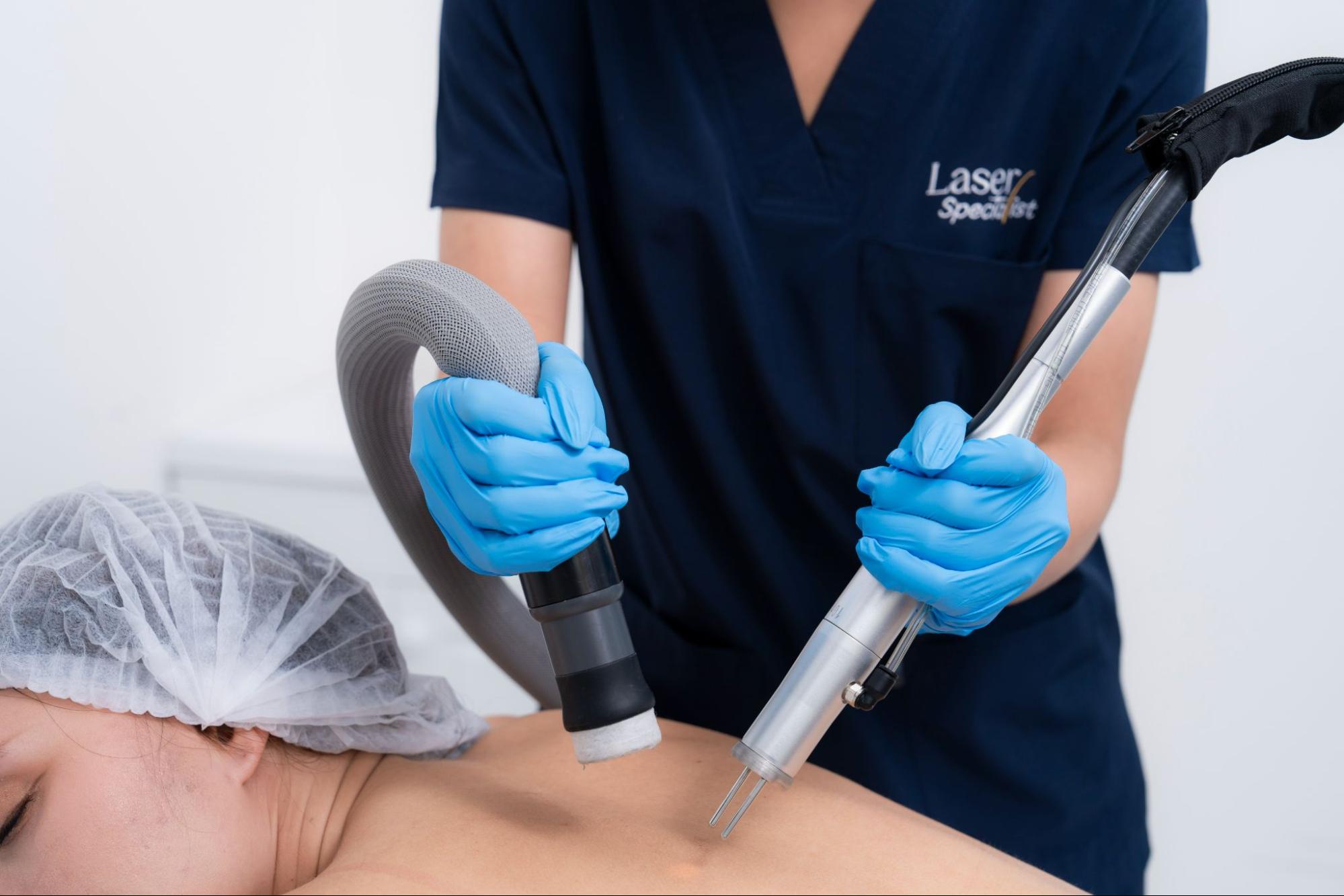 Back Laser Hair Removal Review