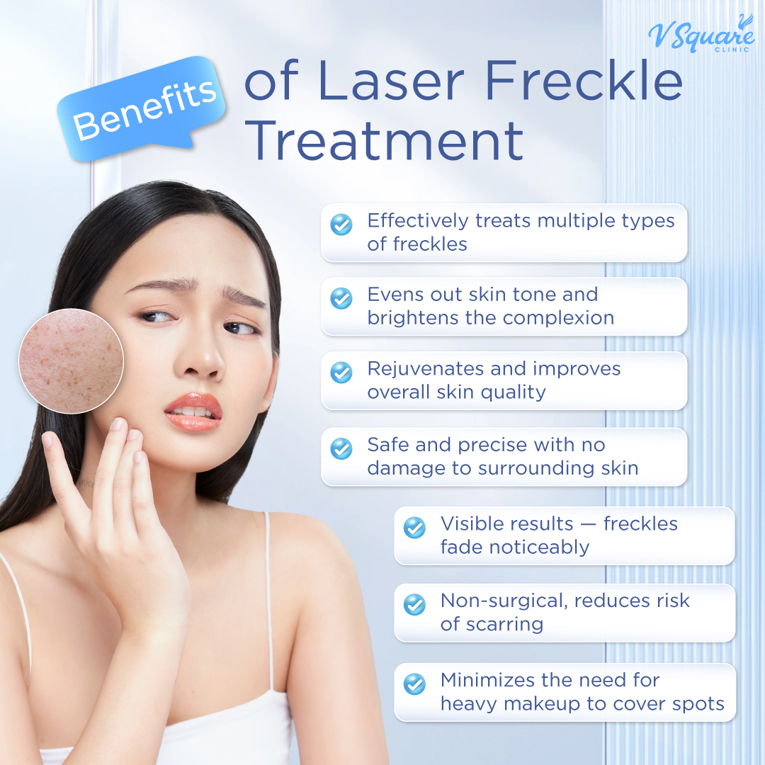 Benefits of laser freckle treatment