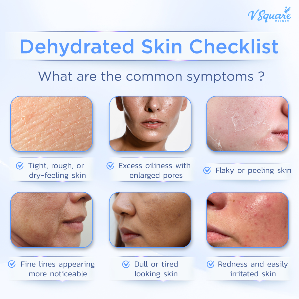 Dehydrated skin characteristics