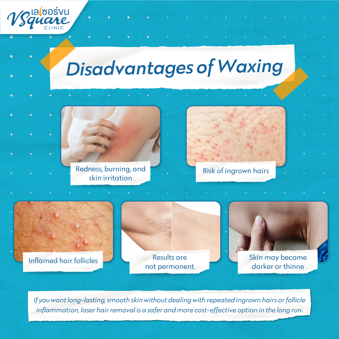 Disadvantages of Wax Hair Removal