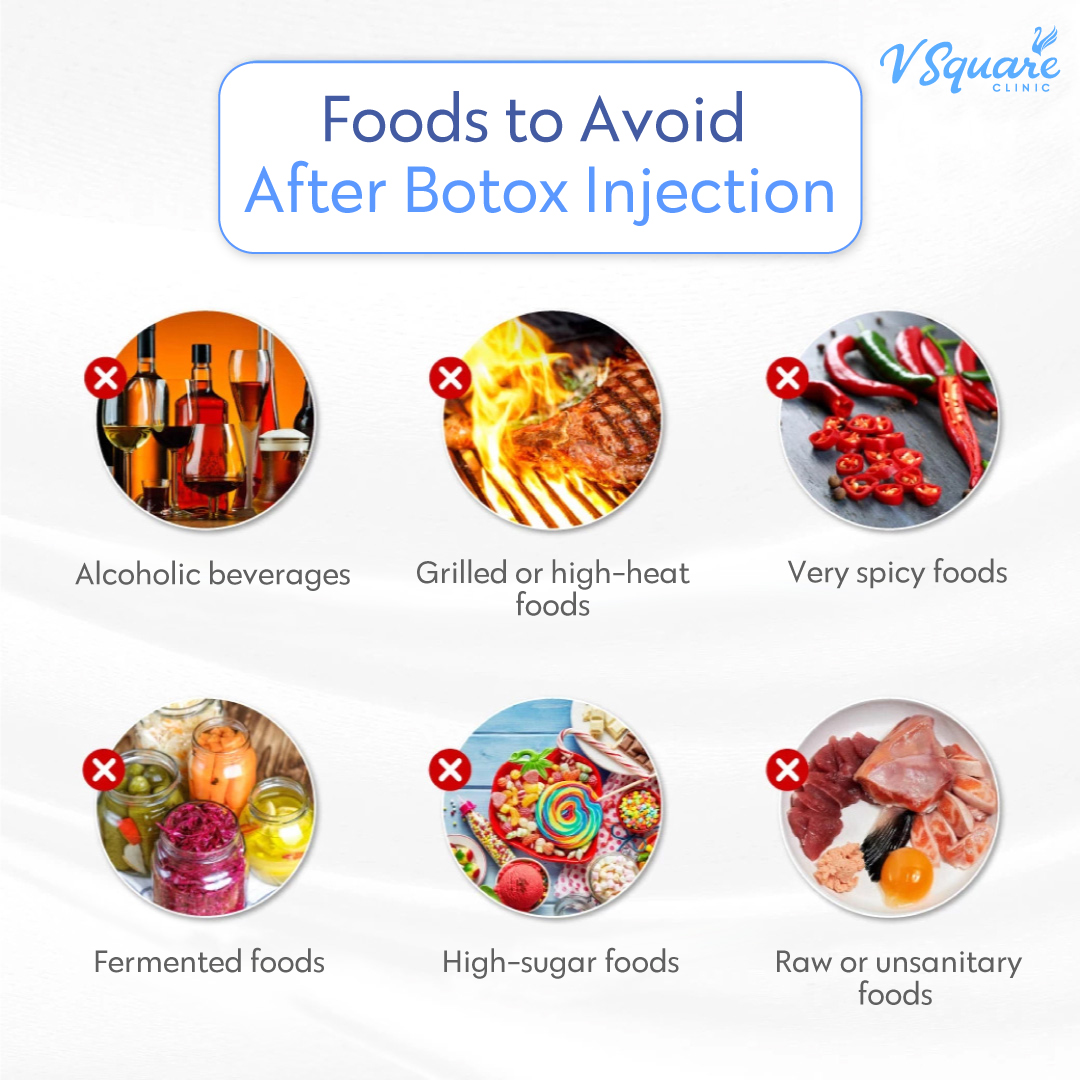 Foods to avoid after inBo Botox