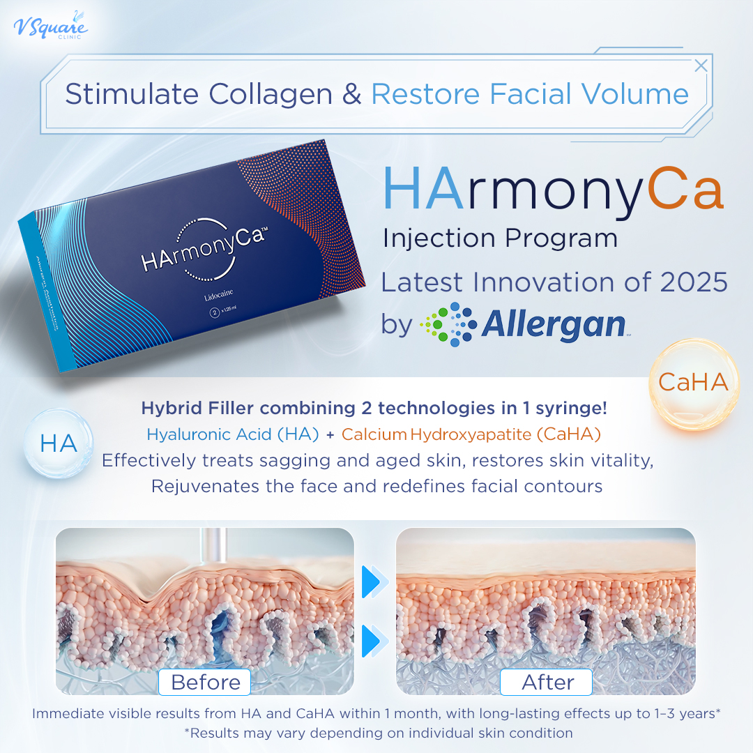 HArmonyCa Collagen Biostimulator for face
