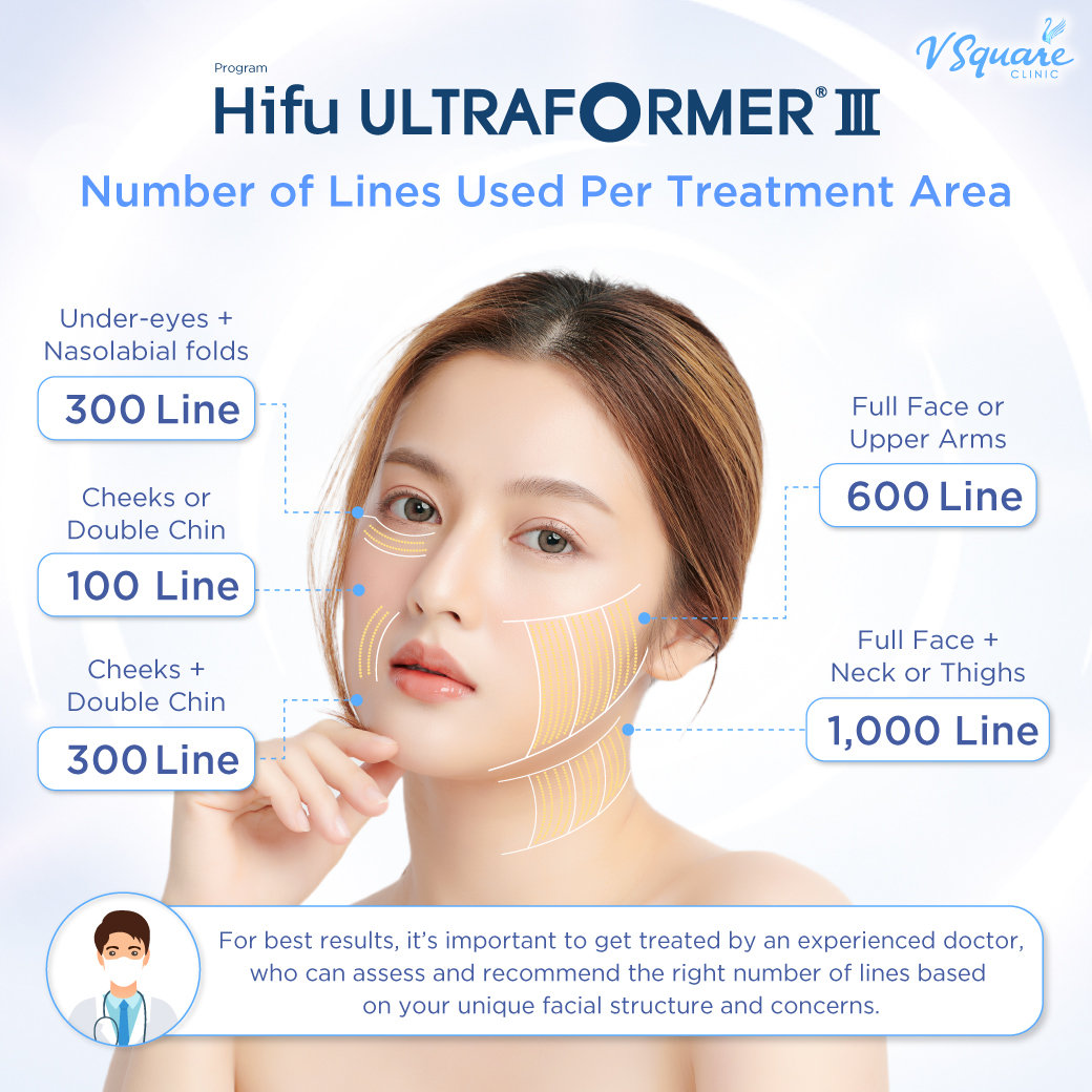 How many Hifu shots are needed for visible results