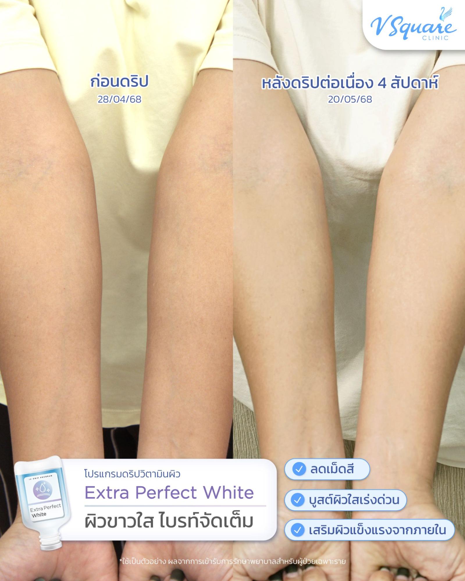 IV drip review for dehydrated skin