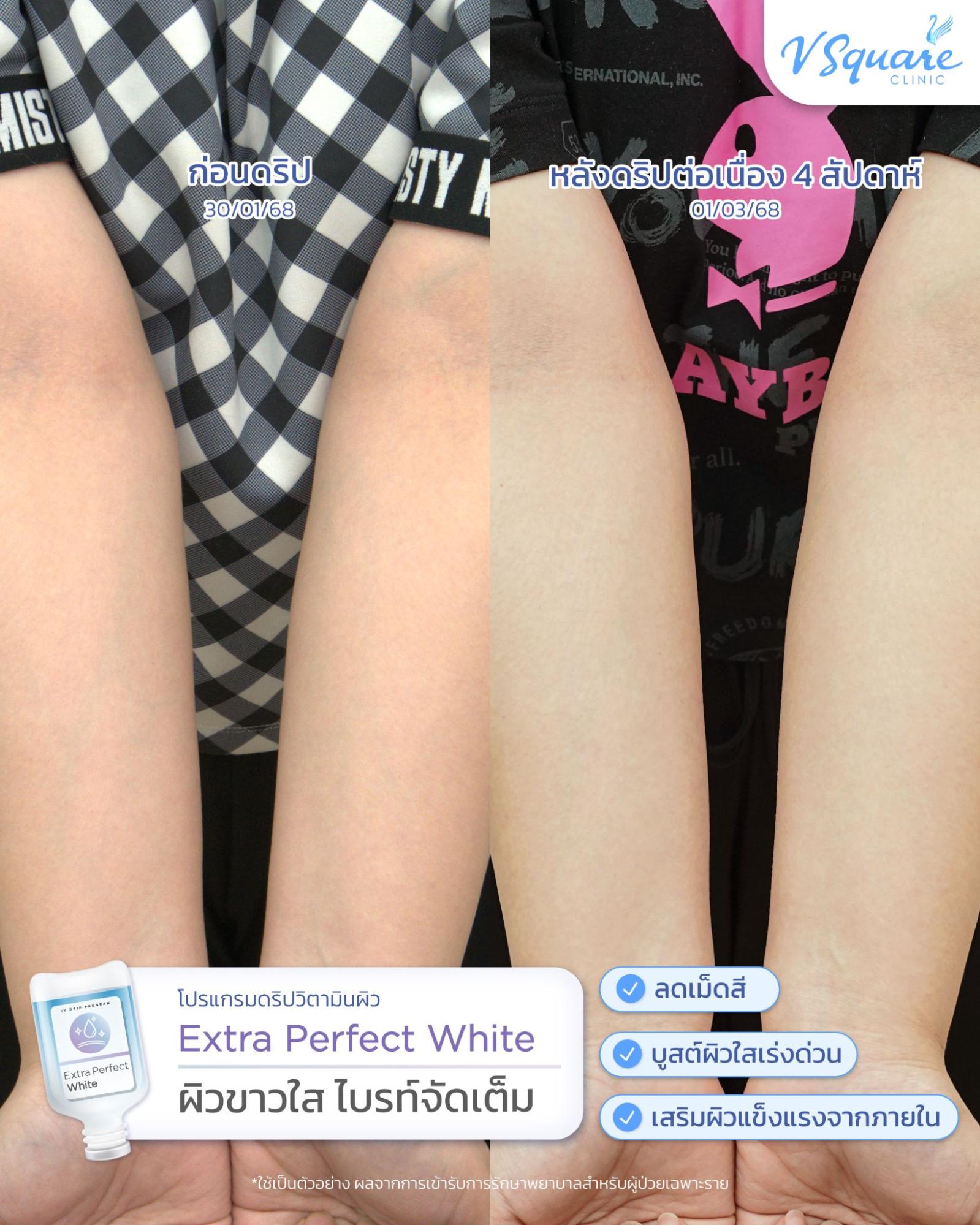 IV drip review for dehydrated skin