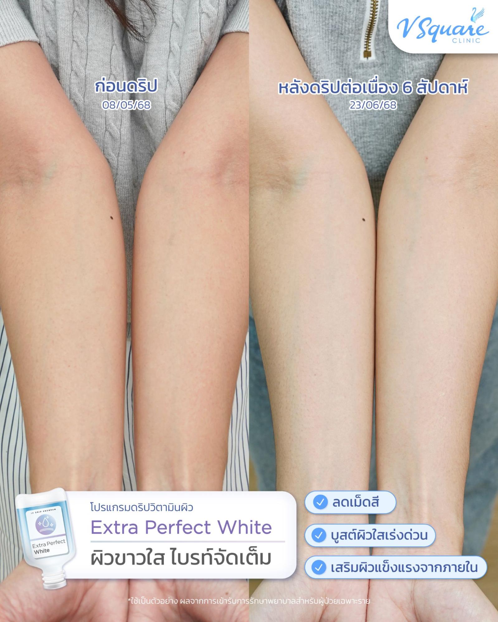 IV drip review for dehydrated skin