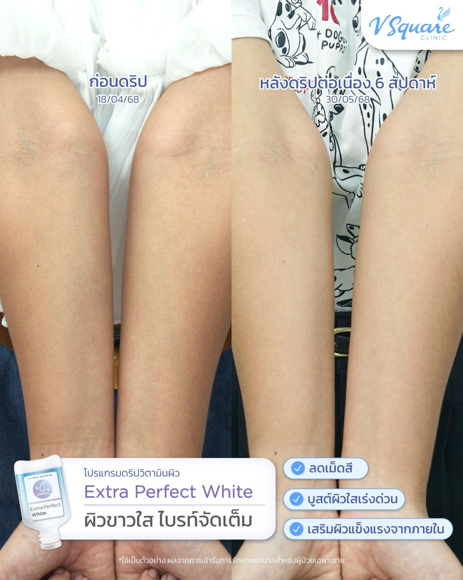 IV drip review for dehydrated skin(5)