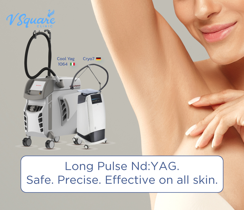 Long Pulse Nd:YAG