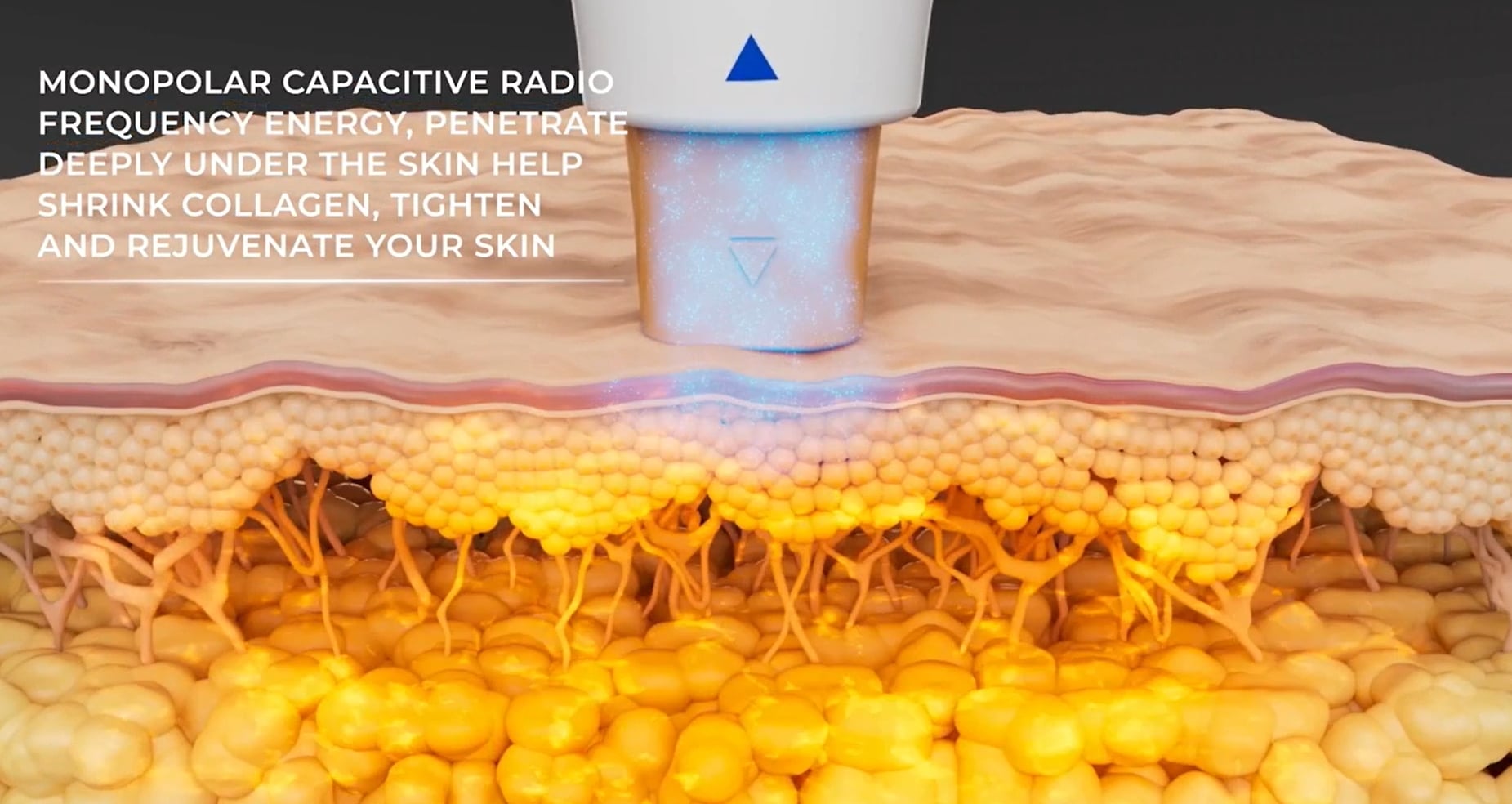 Oligio working principle