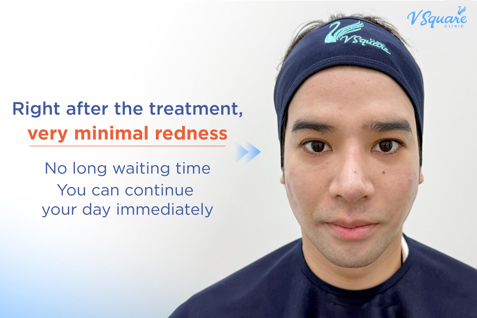 Pico Laser review after treatment