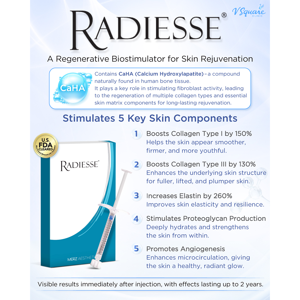 Radiesse Collagen Biostimulator for face