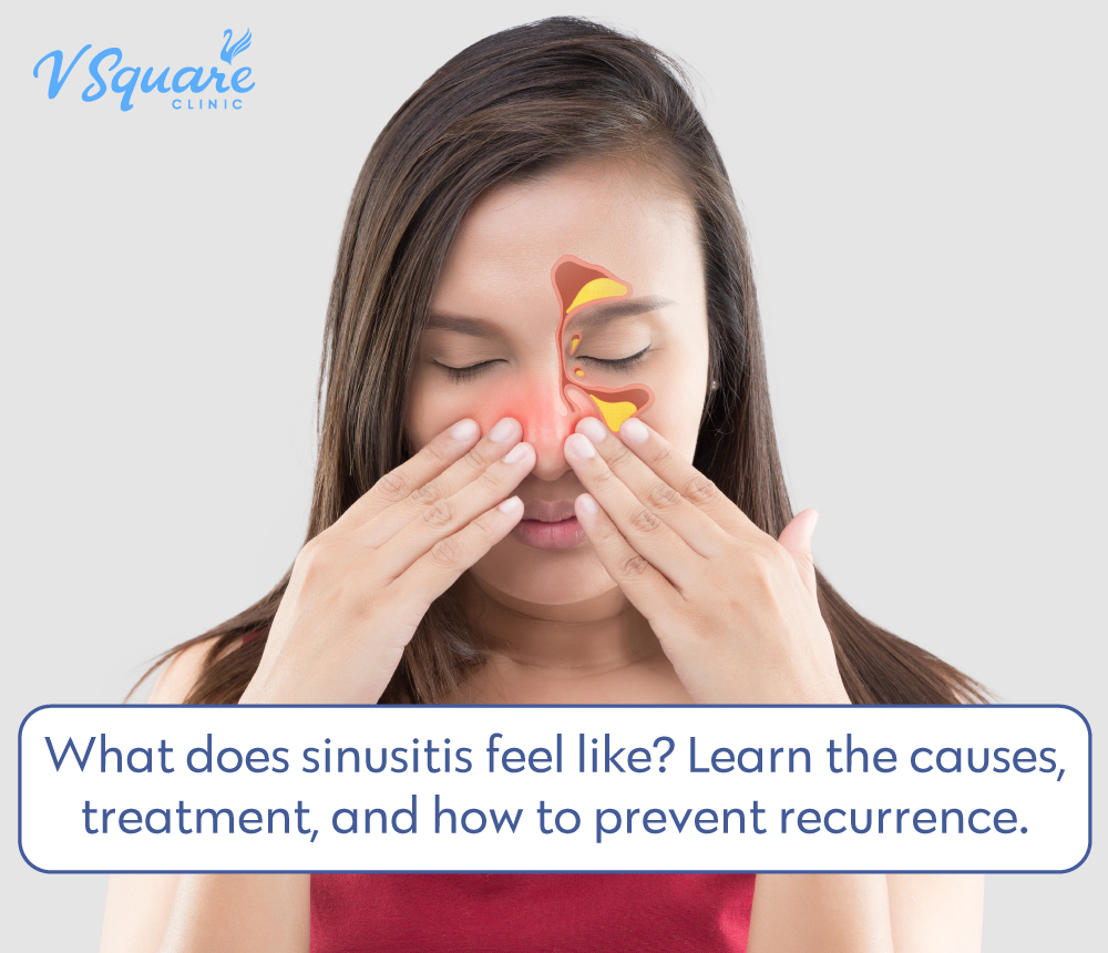 Sinusitis