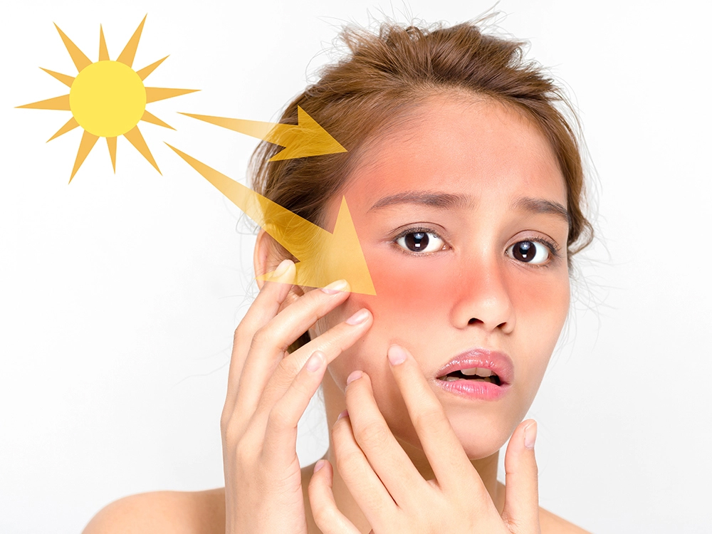 Sun exposure causing Dull Skin