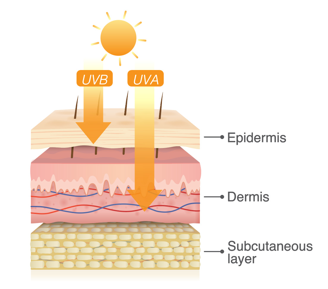 UV radiation causing Dull Skin