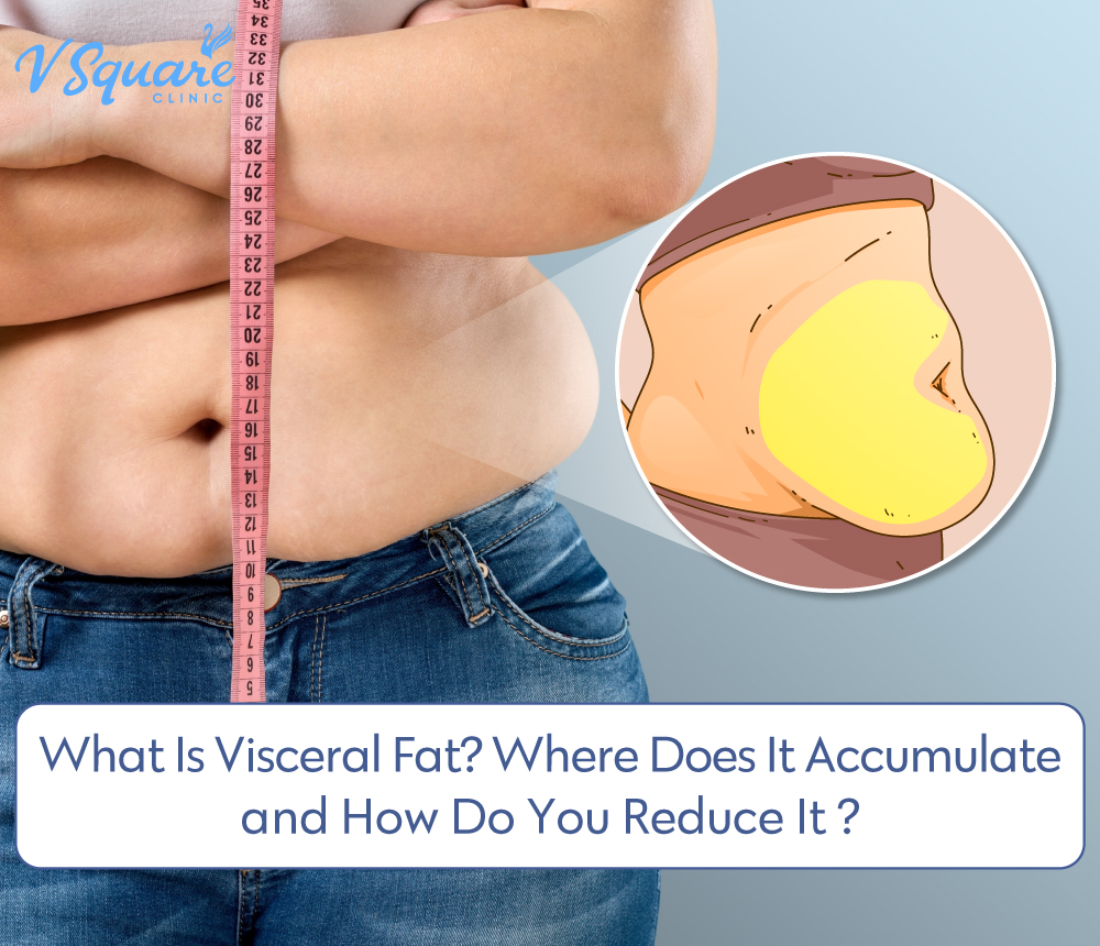What is visceral fat